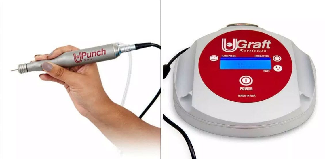Hair transplant - UGraft