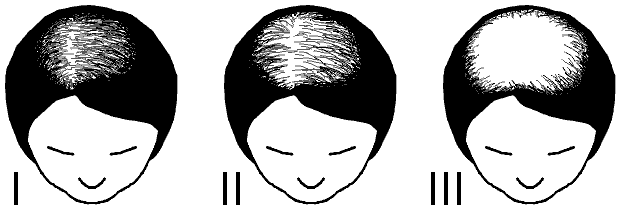 ludwig female