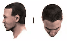 stage 1