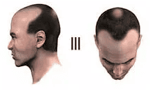 stage 3