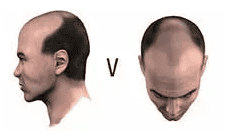 stage 5