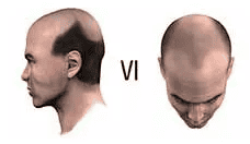 stage 6