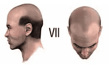 STAGE 7