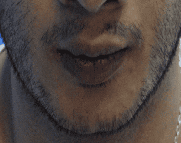 beard before