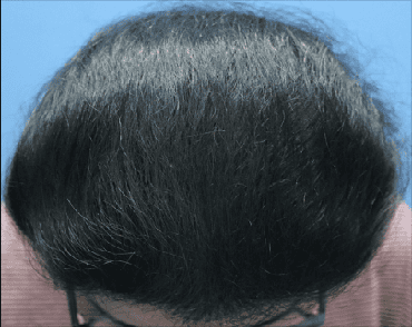 female after