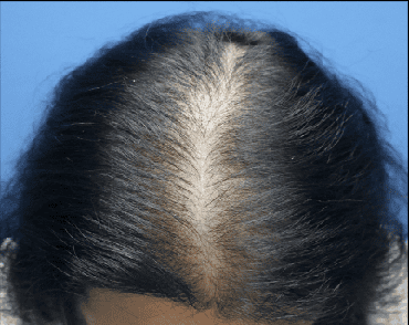 female before
