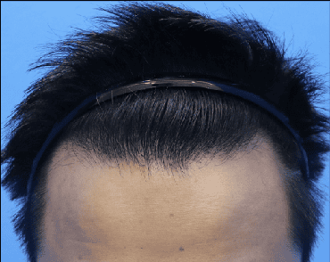 male after