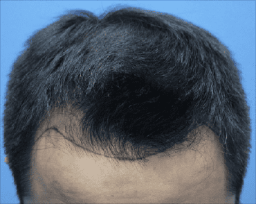 male before