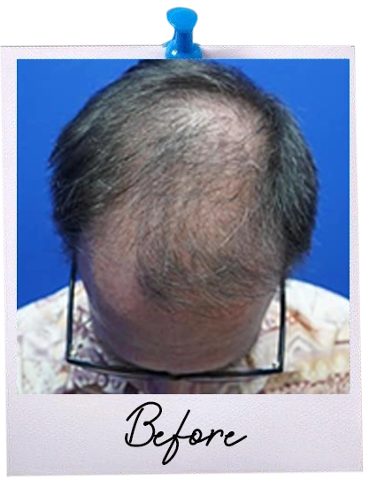 64932666-0-before.webp