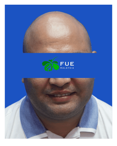 FUE Malaysia - Before 11