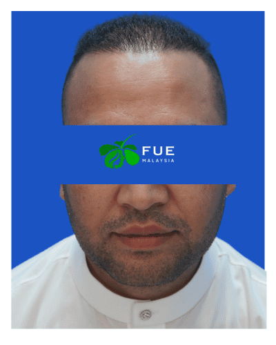 FUE Malaysia - Before 12