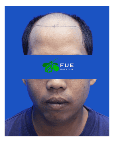 FUE Malaysia - Before 21