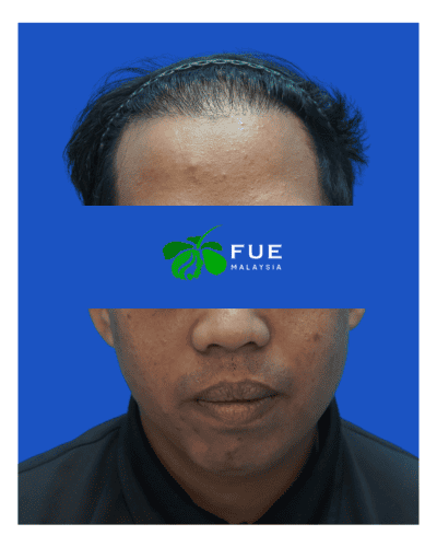 FUE Malaysia - Before 22 (1)