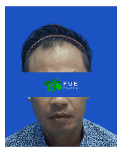 FUE Malaysia - Before 31