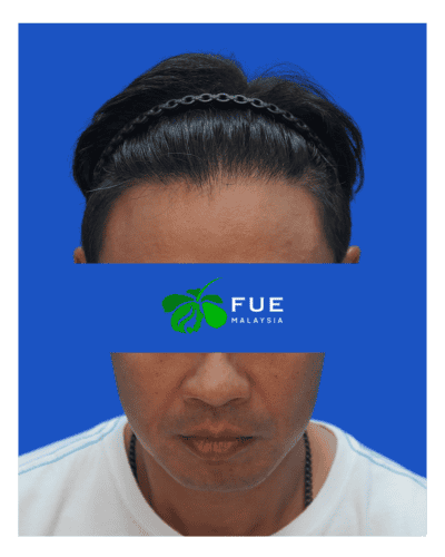FUE Malaysia - Before 32