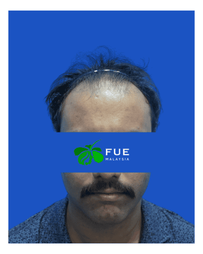 FUE Malaysia - Before 41