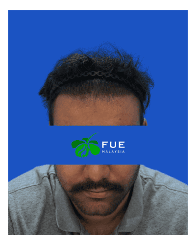 FUE Malaysia - Before 42 (1)