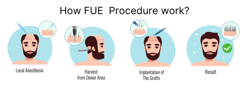 FUE Procedure