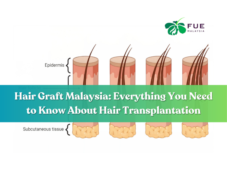 Hair Graft Malaysia Everything You Need to Know About Hair Transplantation
