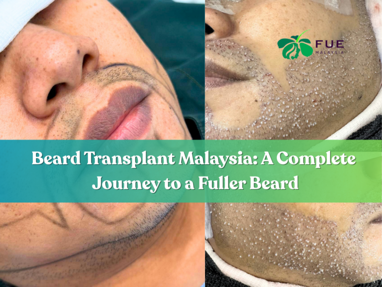 Beard Transplant Malaysia: A Complete Journey to a Fuller Beard