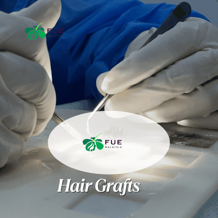 FUE Malaysia - After Procedure - Happy Patient (2)