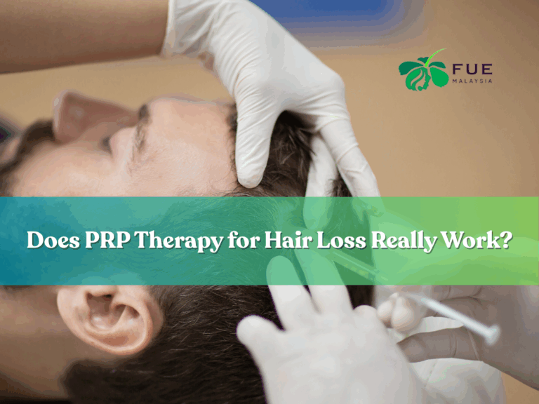 FUE Malaysia - Does PRP Therapy for Hair Loss Really Work