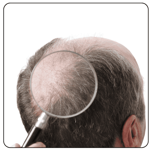Repair Hair Transplant