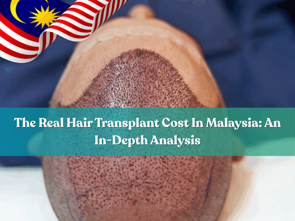 The decision to undergo a hair transplant is a significant step towards regaining confidence and a more youthful appearance. The main question for many is: "How much does a hair transplant actually cost?" At FUE Malaysia, we believe in transparency and empowering you with all the information you need. This guide will provide a comprehensive summary of hair transplant costs in Malaysia, focusing on the advanced Follicular Unit Extraction (FUE) procedure.