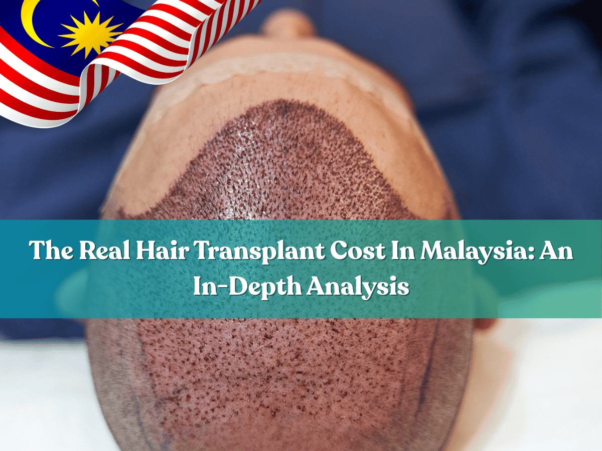 The decision to undergo a hair transplant is a significant step towards regaining confidence and a more youthful appearance. The main question for many is: "How much does a hair transplant actually cost?" At FUE Malaysia, we believe in transparency and empowering you with all the information you need. This guide will provide a comprehensive summary of hair transplant costs in Malaysia, focusing on the advanced Follicular Unit Extraction (FUE) procedure.