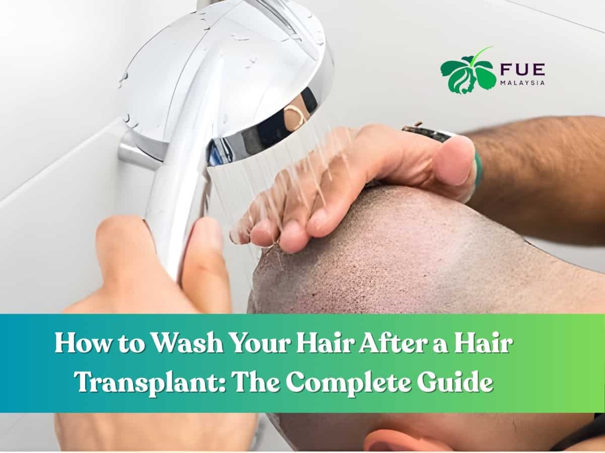 How to Wash Your Hair After a Hair Transplant The Complete Guide