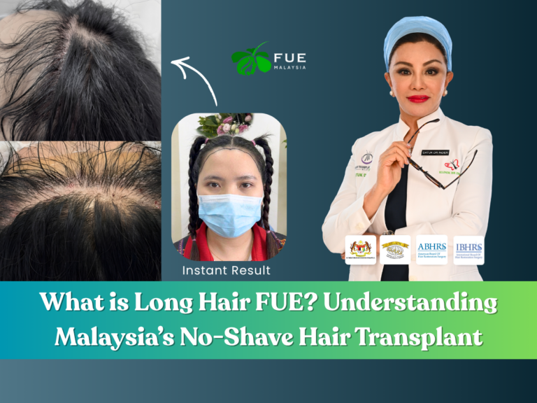 Discover iGraft Long Hair FUE in Malaysia. A discreet, no-shave hair transplant for women by Datuk Dr Inder. Restore your natural hairline with zero downtime.